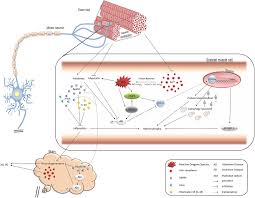 Muscle Pain and Metabolism