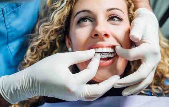Dental Implants